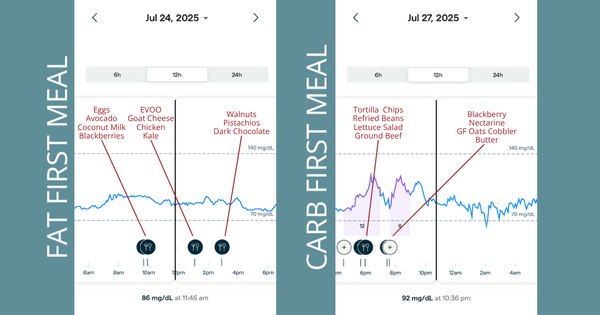 How to Actually Read Your CGM Data (A Functional Practitioner's Guide)