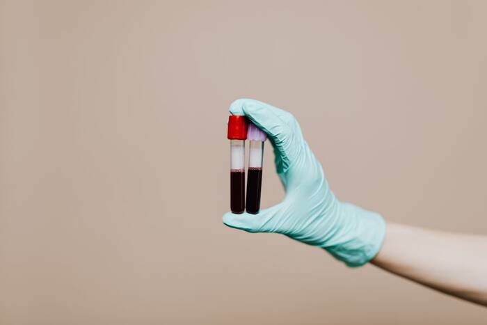 A gloved hand holding lab blood sample tubes